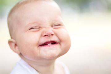 Baby smiling before first dental implant