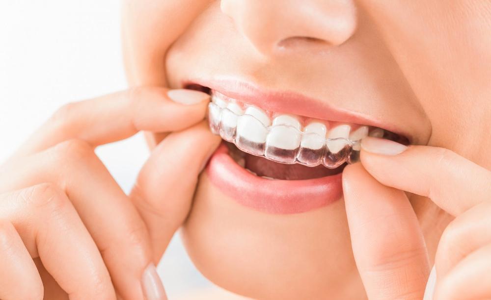 Woman using invisalign | Dentist Monroe WA