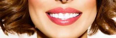 woman with dental implants in monroe, wa