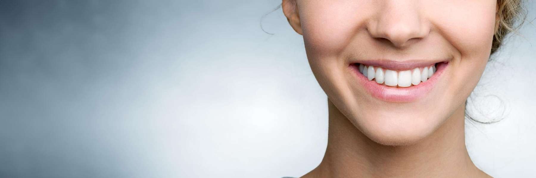 A smile Make-over after a Cosmetic Dentistry at Sky Valley Dental