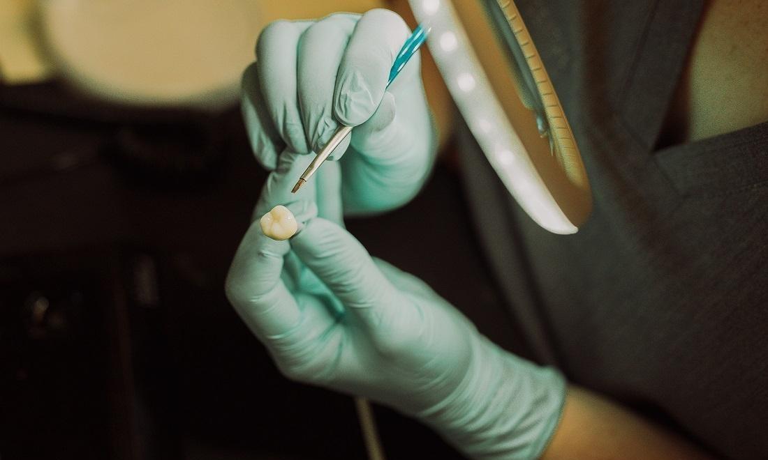 Creating a porcelain crown in Monroe WA