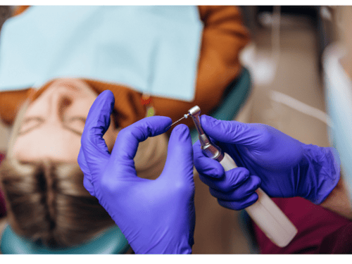Rotary Endodontics